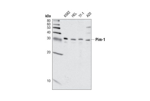 Pim Kinase Antibody Sampler Kit - 1 Kit