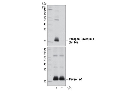 Vesicle Trafficking Antibody Sampler Kit - 1 Kit