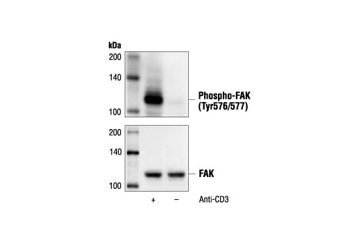 FAK Antibody Sampler Kit - 1 Kit