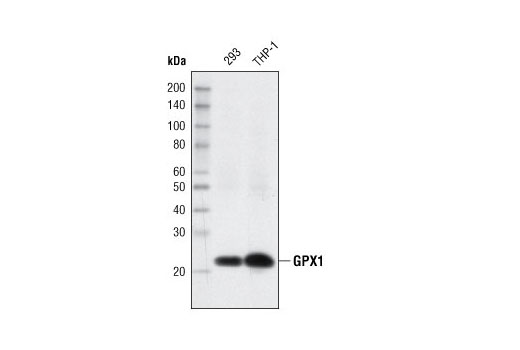 Redox Homeostasis and Signaling Antibody Sampler Kit - 1 Kit