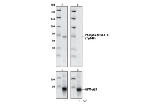 ALK Activation Antibody Sampler Kit - 1 Kit