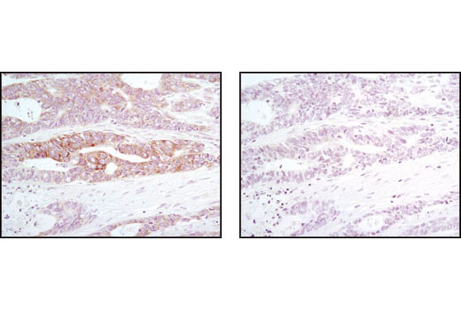 PhosphoPlus® eIF2α (Ser51) Antibody Duet - 1 Kit