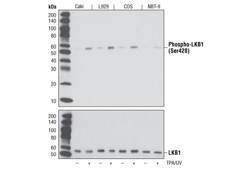 PhosphoPlus® LKB1 (Ser428) Antibody Duet - 1 Kit