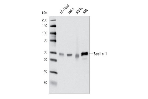 Beclin-1 Complex Antibody Sampler Kit - 1 Kit