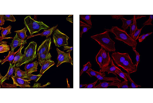 Myosin Light Chain 2 Antibody Sampler Kit - 1 Kit