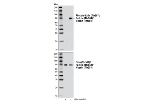 Actin Reorganization Antibody Sampler Kit - 1 Kit