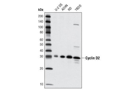 Cyclin Antibody Sampler Kit - 1 Kit