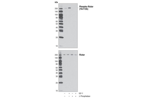 PhosphoPlus® Rictor (Thr1135) Antibody Duet - 1 Kit