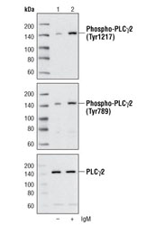 PLCγ Antibody Sampler Kit - 1 Kit