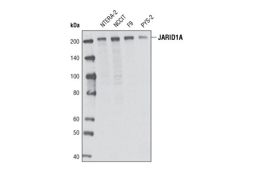 JARID1/KDM5 Histone Demethylase Antibody Sampler Kit - 1 Kit