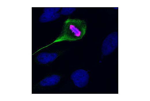 Vimentin Antibody Sampler Kit - 1 Kit