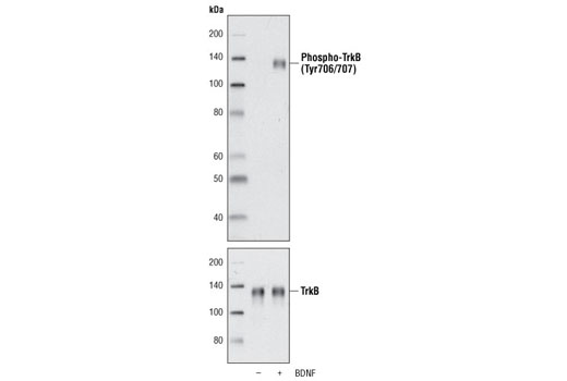 Human Brain-Derived Neurotrophic Factor (BDNF) Recombinant Protein - 10 ug