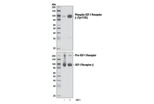 Phospho-Insulin/IGF Receptor Antibody Sampler Kit - 1 Kit