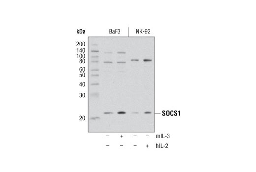 Jak/Stat Pathway Inhibitors Antibody Sampler Kit - 1 Kit