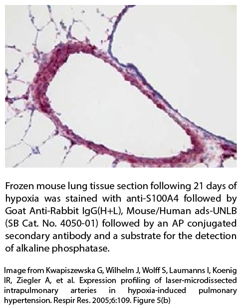 Goat Anti-Rabbit IgG(H+L), Mouse/Human ads-UNLB - 1.0 mg