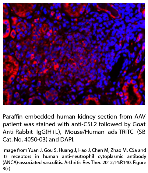 Goat Anti-Rabbit IgG(H+L), Mouse/Human ads-TRITC - 1.0 mg