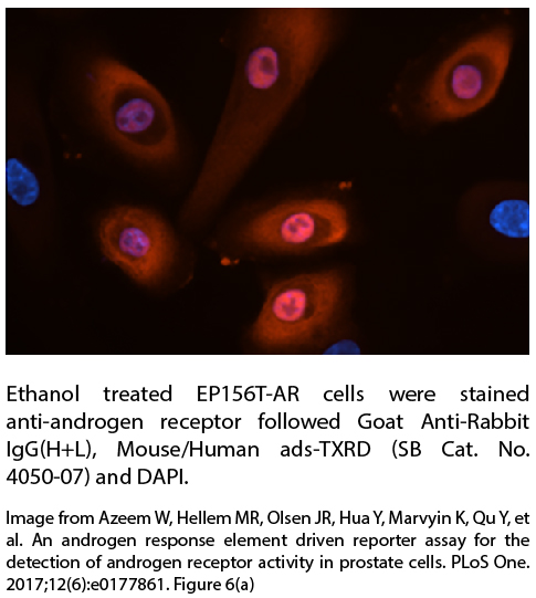 Goat Anti-Rabbit IgG(H+L), Mouse/Human ads-TXRD - 1.0 mg