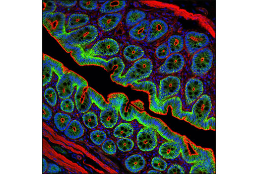 PhosphoPlus® β-Catenin (Ser675) Antibody Duet - 1 Kit