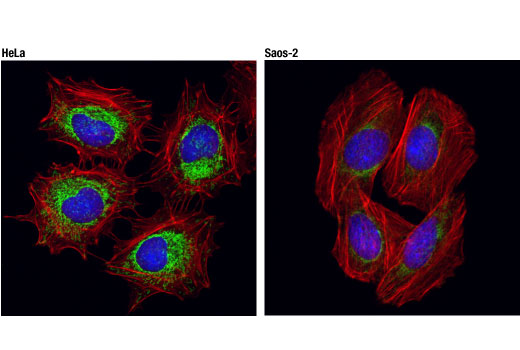 Mitochondrial Dynamics Antibody Sampler Kit II - 1 Kit