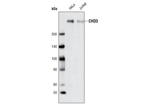 NuRD Complex Antibody Sampler Kit - 1 Kit