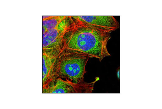 Anti-rabbit IgG (H+L), F(ab')2 Fragment (Alexa Fluor® 488 Conjugate) - 250 ul