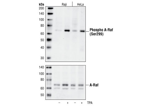 Raf Family Antibody Sampler Kit - 1 Kit