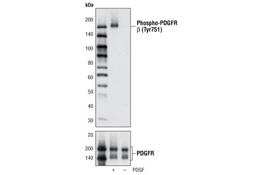 PDGF Receptor Activation Antibody Sampler Kit - 1 Kit