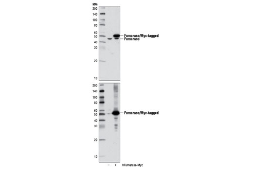 Tricarboxylic Acid Cycle Antibody Sampler Kit - 1 Kit