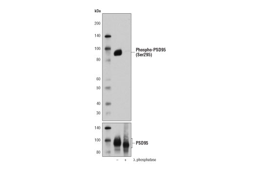 PhosphoPlus® PSD95 (Ser295) Antibody Duet - 1 Kit