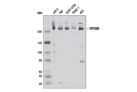 Autophagy Induction (ULK1 Complex) Antibody Sampler Kit - 1 Kit