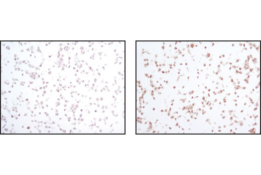 Phospho-SAPK/JNK Pathway Antibody Sampler Kit - 1 Kit