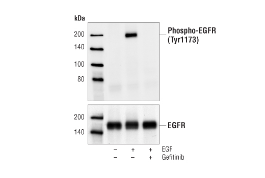 Gefitinib - 10 mg