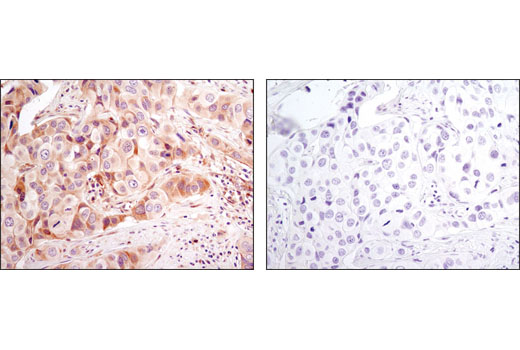 Pro-Apoptosis Bcl-2 Family Antibody Sampler Kit II - 1 Kit