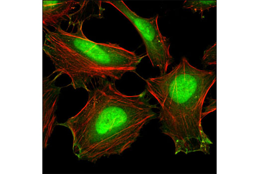 Cofilin Activation Antibody Sampler Kit - 1 Kit