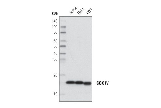 Loading Control Antibody Sampler Kit (HRP Conjugate) - 1 Kit