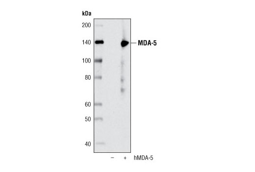 Rig-I Pathway Antibody Sampler Kit - 1 Kit