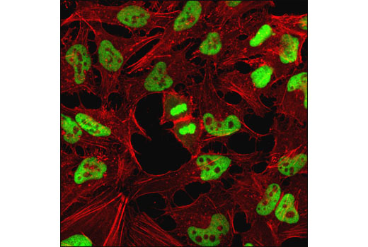 Histone Deacetylase (HDAC) Antibody Sampler Kit - 1 Kit