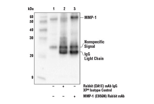 ECM Profiling Antibody Sampler Kit - 1 Kit