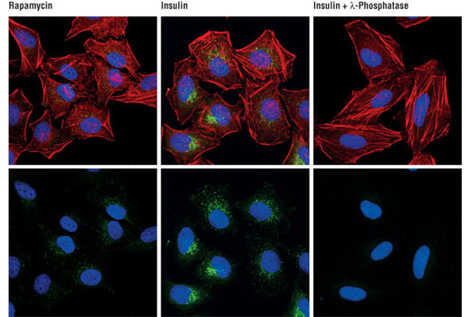 PhosphoPlus® mTOR (Ser2448) Antibody Duet - 1 Kit