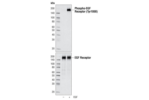 EGF Receptor Control Cell Extracts - 150 ul