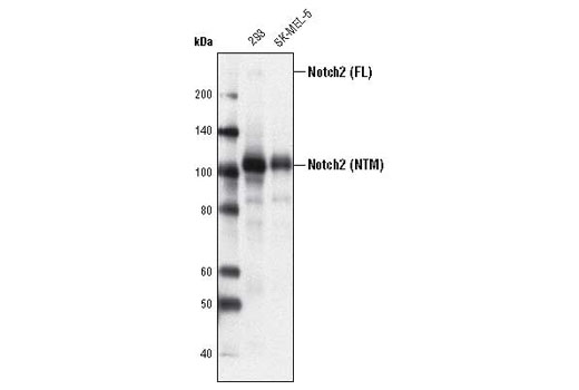 Notch Isoform Antibody Sampler Kit - 1 Kit