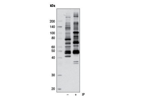 Phospho-(Ser/Thr) Kinase Substrate Antibody Sampler Kit - 1 Kit