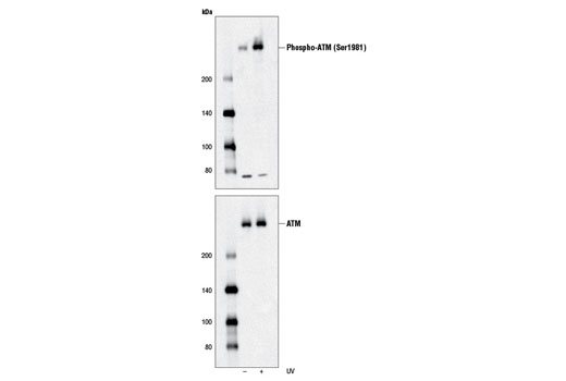 Double Strand Breaks (DSB) Repair Antibody Sampler Kit - 1 Kit