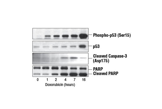 Doxorubicin - 5 mg