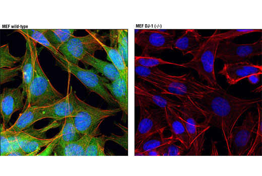 Parkinson's Research Antibody Sampler Kit - 1 Kit