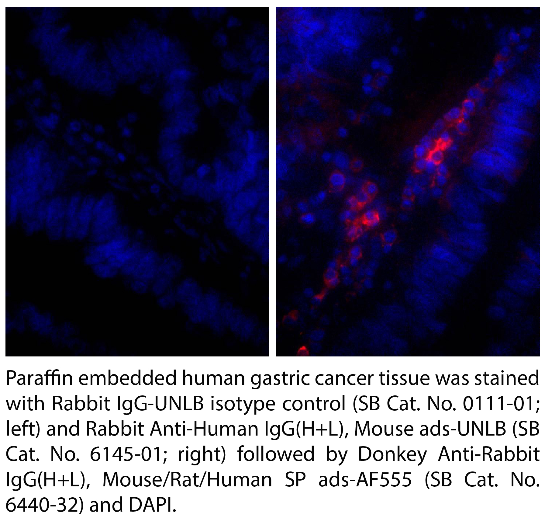 Rabbit Anti-Human IgG(H+L), Mouse ads-UNLB - 1.0 mg