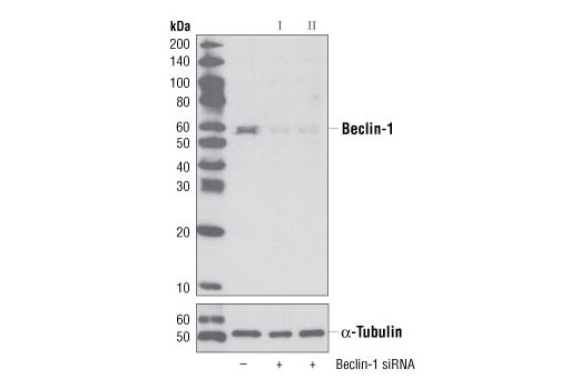 SignalSilence® Beclin-1 siRNA I - 300 ul