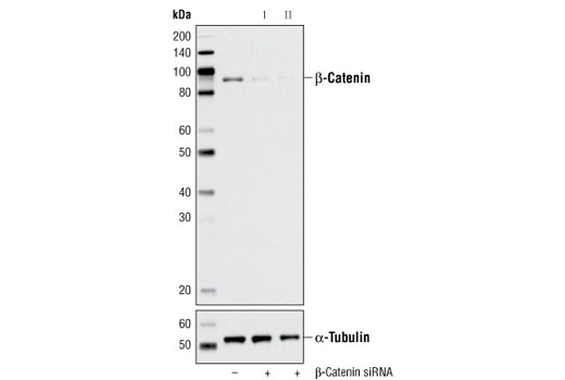 SignalSilence® β-Catenin siRNA I - 300 ul