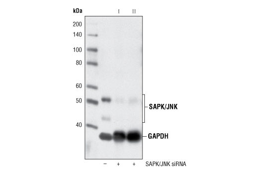 SignalSilence® SAPK/JNK siRNA I - 300 ul