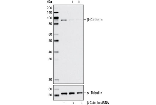 SignalSilence® β-Catenin siRNA II - 300 ul